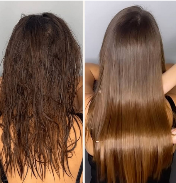 Avant et Après application du soin Botox ONIX LISS
